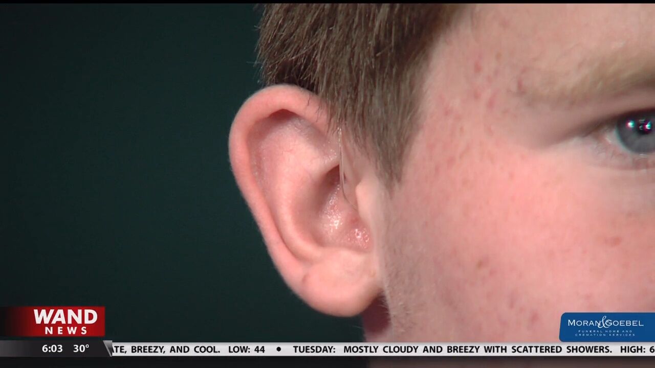 Teen urges lawmakers to expand hearing aid coverage
